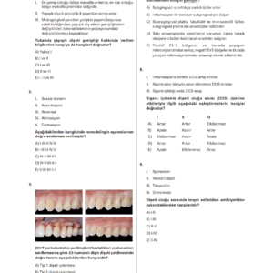 Periodontoloji Branş Denemeleri - Görsel 3